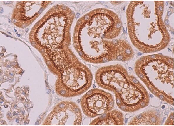 GIPC抗体(B-12) | SCBT - Santa Cruz Biotechnology