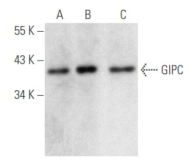 Aページ♡⃜ プラットチャンキースニーカー（スニーカー）｜PAGEBOY（ページ