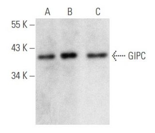 western blotting image from recommended GIPC (B-12) monoclonal antibody replacement. Image 354789