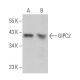 GIPC2 Antibody (G-7) - Western Blotting - Image 371116 