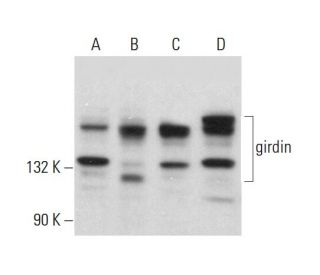 western blotting image from recommended girdin (H-6) monoclonal antibody replacement. Image 382298
