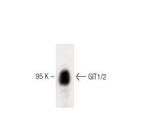 GIT1/2 Antibody (13) - Western Blotting - Image 60448 