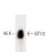 GIT1/2 Antibody (13) - Western Blotting - Image 60448 