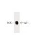 GIT1 Antibody (13) - Western Blotting - Image 60390 