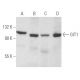 This polyclonal antibody has been discontinued. See our recommended <a href="git1-antibody-a-1">GIT1 (A-1)</a> monoclonal antibody (sample data shown). western blotting image from recommended GIT1 (A-1) monoclonal antibody replacement. Image 356126