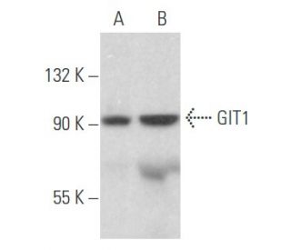 GIT1 Antibody (B-2) - Western Blotting - Image 356125 