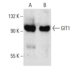 GIT1 Antibody (E-7) - Western Blotting - Image 387364 