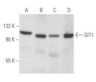 western blotting image from recommended GIT1 (A-1) monoclonal antibody replacement. Image 356126