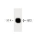 GIT2 Antibody (27) - Western Blotting - Image 60211 
