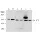GIT2 Antibody (E-5) - Western Blotting - Image 345895