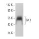 GK1 Antibody (E-4) - Western Blotting - Image 367629
