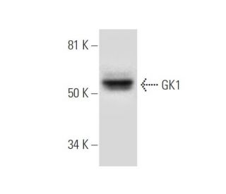 GK1 Antibody (F-5) - Western Blotting - Image 297601