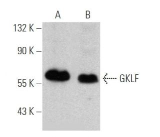 GKLF/KLF4 Antibody (B-9) - Western Blotting - Image 370720 