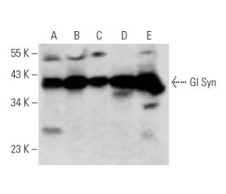 Gl Syn Antibody (E-2) - Western Blotting - Image 356275 