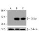 Anticuerpo Gl Syn (E-3): sc-515027. Análisis por Western blot de la expresión de Gl Syn en lisados celulares K-562 no tratados (A) y tratados químicamente (B, C). β-Actina (C4): sc-47778 utilizado como control de carga. Reactivo de detección utilizado: m-IgG Fc BP-HRP: sc-525409. Gl Syn Antibody (E-3) - Western Blotting - Image 415855