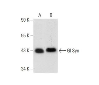 Gl Syn Antibody (F-4) - Western Blotting - Image 300475 