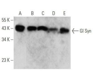 western blotting image from recommended Gl Syn (E-4) monoclonal antibody replacement. Image 356273