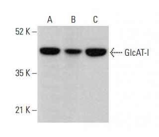 GlcAT-I Antibody (D-7) - Western Blotting - Image 375585 