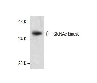 GlcNAc kinase Antibody (G-5) - Western Blotting - Image 288581 