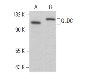 GLDC Antibody (H-9) - Western Blotting - Image 364023 