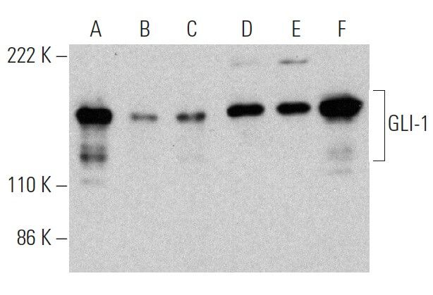 gli-1-antibody-c-1-western-