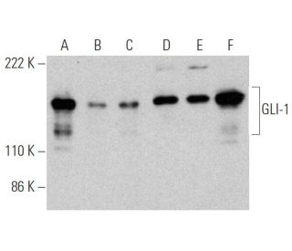 western blotting image from recommended GLI-1/GLI1 (C-1) monoclonal antibody replacement. Image 363219