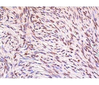 GLI-2 Antibody (C-10) | SCBT - Santa Cruz Biotechnology