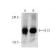 western blotting image from recommended GLI-2 (C-10) monoclonal antibody replacement. Image 136360