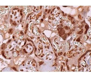 immunohistochemistry image from recommended GLI-3 (B-4) monoclonal antibody replacement. Image 368922
