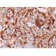 immunohistochemistry image from recommended GLI-3 (B-4) monoclonal antibody replacement. Image 368922