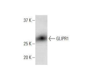 GLIPR1 Antibody (8D9) - Western Blotting - Image 352180 