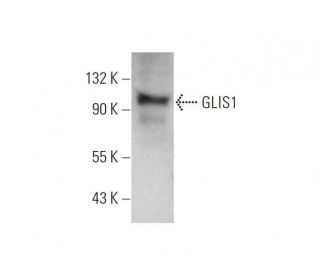 GLIS1 Antibody (A-3) - Western Blotting - Image 353410 