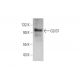 GLIS1 Antibody (A-3) - Western Blotting - Image 353410 