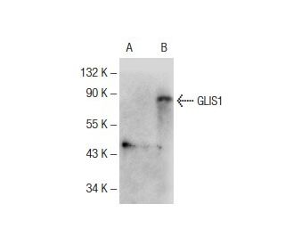 GLIS1 Antibody (E-6) - Western Blotting - Image 145661