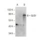 GLIS1 Antibody (E-6) - Western Blotting - Image 145661