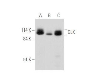 GLK Antibody (C-6) - Western Blotting - Image 333808 