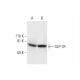 GLP-1R Antibody (B-11) - Western Blotting - Image 290886