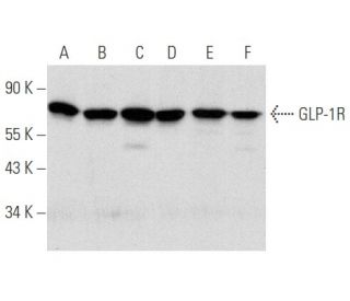 GLP-1R Antibody (B-11) - Western Blotting - Image 354839 