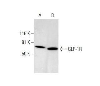 GLP-1R Antibody (D-6)