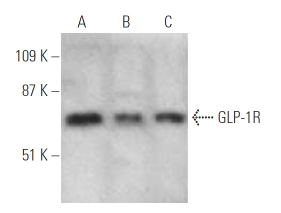 GLP-1R Antibody (D-6) | SCBT - Santa Cruz Biotechnology