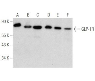 western blotting image from recommended GLP-1R (D-6) monoclonal antibody replacement. Image 354838