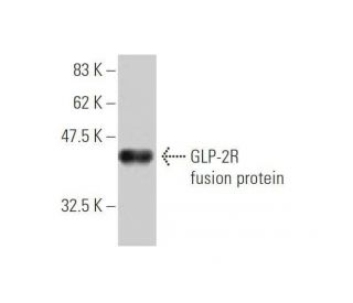 GLP-2R Antibody (1F2) - Western Blotting - Image 348996