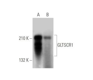 GLTSCR1 Antibody (H-10) - Western Blotting - Image 344065 