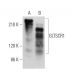 GLTSCR1 Antibody (H-10) - Western Blotting - Image 373273 