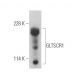GLTSCR1 Antibody (H-10) - Western Blotting - Image 394968