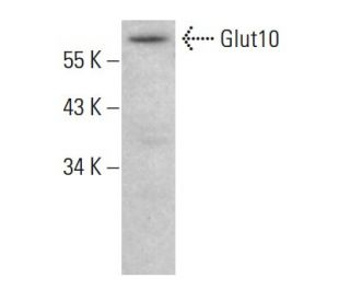 Glucose Transporter Glut10 Antibody (H-10) - Western Blotting - Image 384768Each CRISPR/Cas9 Knockout (KO) Plasmid product consists of a pool of 3 plasmids designed to ensure identification and cleavage of a specific gene for maximum knockout efficiency. Each plasmid encodes a unique 20 nt sequence derived from the GeCKO (v2) library.