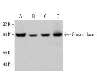 Glucosidase I Antibody (C-11) - Western Blotting - Image 372600 
