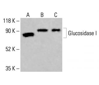 Glucosidase I Antibody (H-6) - Western Blotting - Image 414283 