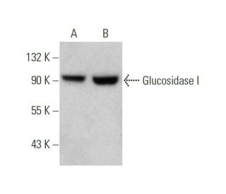 Glucosidase I Antibody (H-6) - Western Blotting - Image 353434