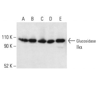 Glucosidase II&alpha; Antibody (D-1) - Western Blotting - Image 403800 